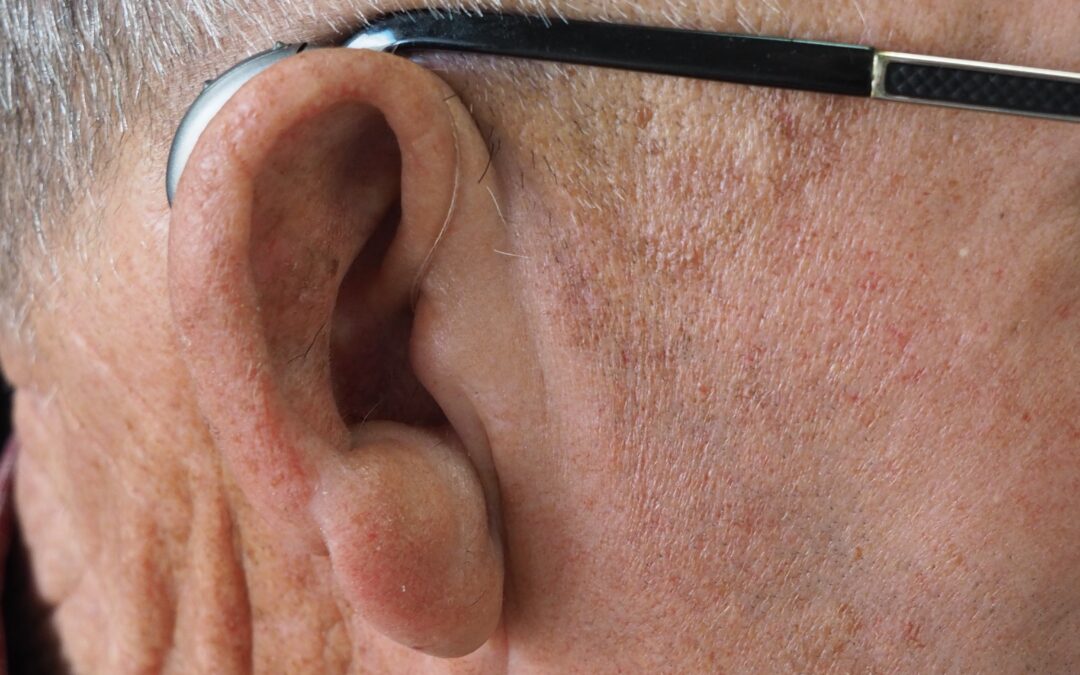 Apparecchi acustici Foligno